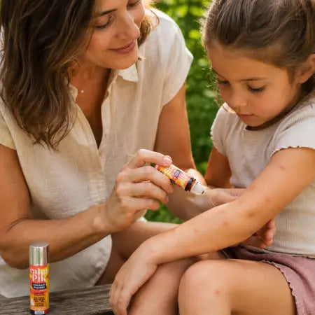 Madre aplicando calmante natural para picaduras de mosquito en roll-on a una niña pequeña con múltiples picaduras en brazos y piernas al aire libre